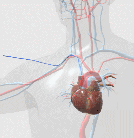 人体 心脏mems植入场景1动画GLB/GLTF模型